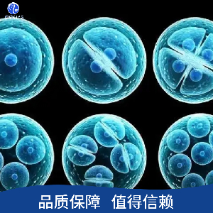 人子宫内膜低分化腺癌细胞