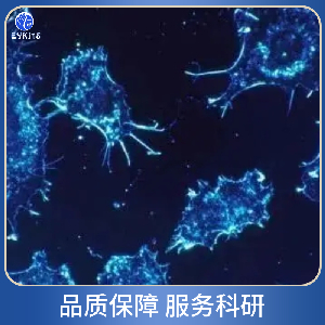 人纤维肉瘤细胞