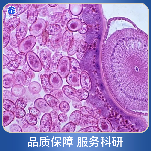 人胶质母细胞瘤细胞