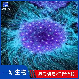 人神经胶质瘤细胞