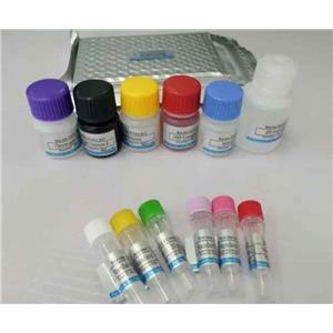 人巨噬细胞炎症蛋白1β（MIP-1β/CCL4）Elisa试剂盒