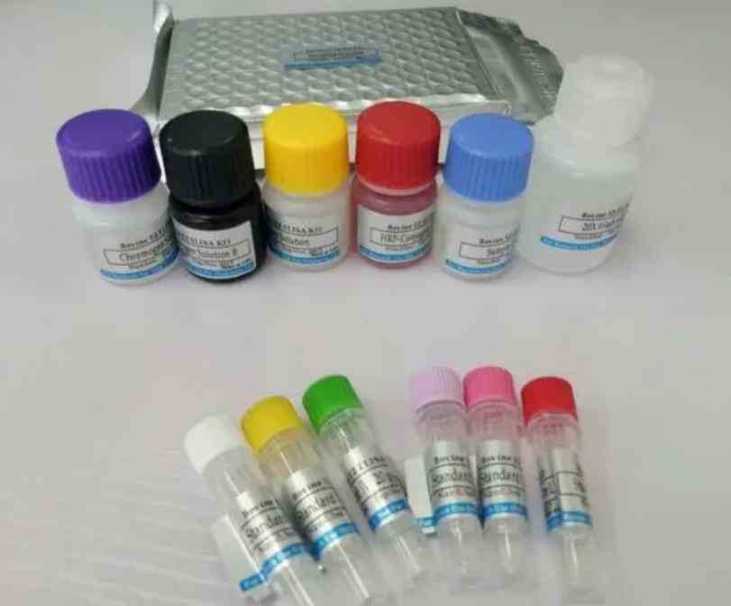人血管肠肽（VIP）Elisa试剂盒,Human VIP(Vasoactive Intestinal Peptide) ELISA Kit