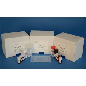 人Ⅰ型胶原交联羧基端肽(CTXⅠ)Elisa试剂盒,Human CTXⅠ(Cross Linked C-telopeptide of Type Ⅰ Collagen) ELISA Kit