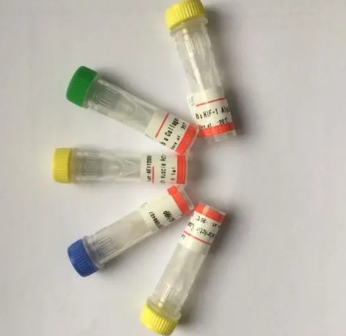 DKK1  Antibody,DKK1  Antibody