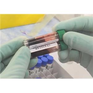 DNMT3A Antibody生产供应商艾普蒂生物
