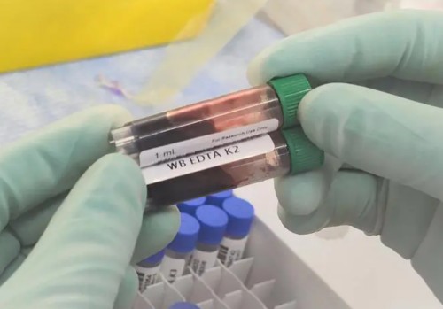 Survivin Antibody,Survivin Antibody