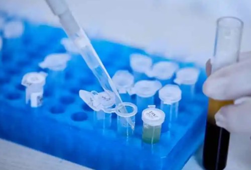 UBA1 Antibody,UBA1 Antibody