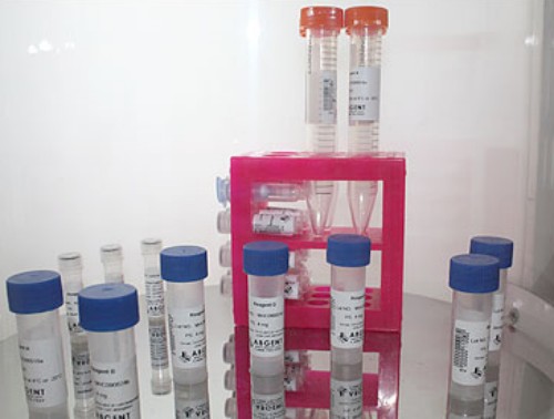 YB1 Antibody,YB1 Antibody