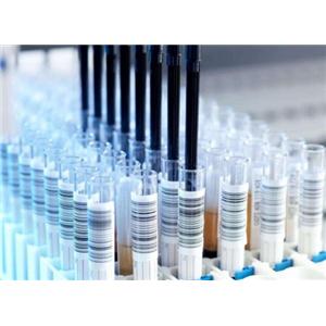 APCS Antibody,APCS Antibody