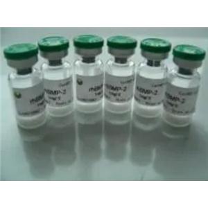 重组 人QPRT 蛋白,Recombinant human QPRT protein