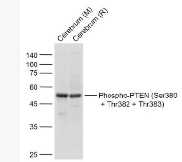 Phospho-PTEN (Ser380 + Thr382 + Thr383)-磷酸化腫瘤抑制基因PTEN抗體,RabbitAnti-Phospho-PTEN (Ser380 + Thr382 + Thr383) antibody