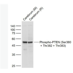 Phospho-PTEN (Ser380 + Thr382 + Thr383)-磷酸化腫瘤抑制基因PTEN抗體,RabbitAnti-Phospho-PTEN (Ser380 + Thr382 + Thr383) antibody