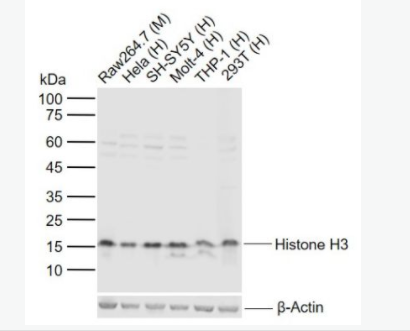 Anti-Histone H3-组蛋白H3（核内参）抗体,Histone H3 (Nuclear Loading Control)