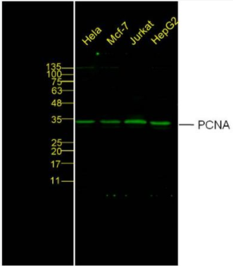 Anti-PCNA-增殖细胞核抗原抗体,RabbitAnti-PCNA antibody
