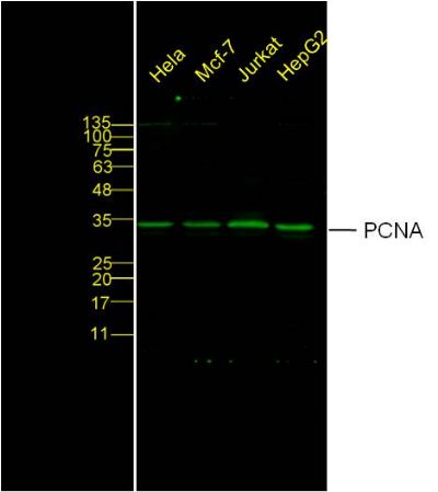 增殖细胞核抗原抗体,PCNA