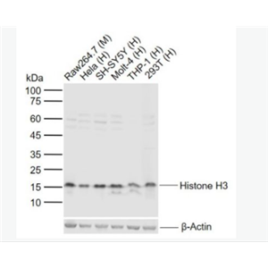 Anti-Histone H3-组蛋白H3（核内参）抗体