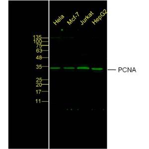 增殖细胞核抗原抗体,PCNA