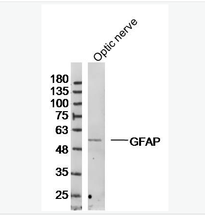 胶质纤维酸性蛋白抗体,GFAP