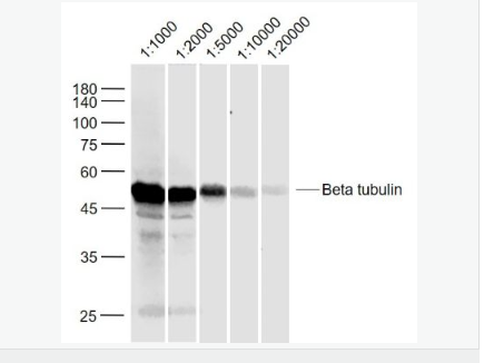 微管蛋白β tubulin/Tubulin β（内参）抗体,Beta tubulin (Loading Control)