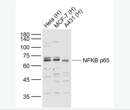 細(xì)胞核因子/k基因結(jié)合核因子抗體,NFKB p65