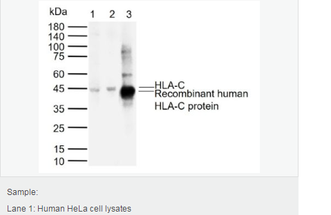 Anti-HLA-C antibody-组织相容性蛋白1单克隆抗体,HLA-C