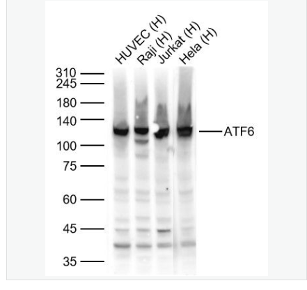 ATF6 antibody-活化转录因子6抗体,ATF6