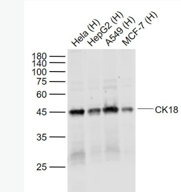 Anti-CK18 antibody-细胞角蛋白18单克隆抗体,CK18
