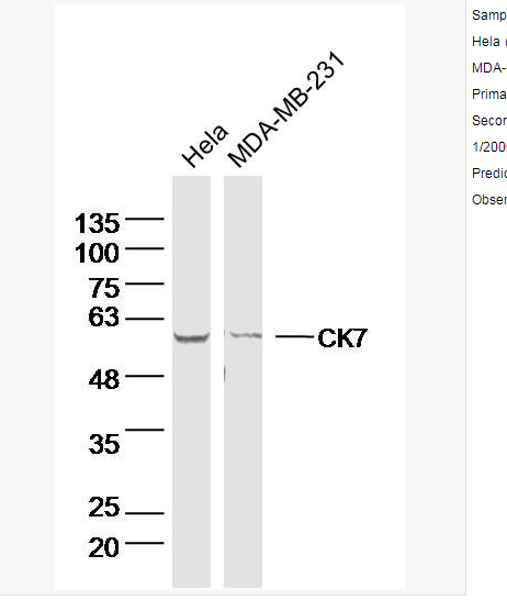 Anti-CK7 antibody-细胞角蛋白7单克隆抗体,CK7