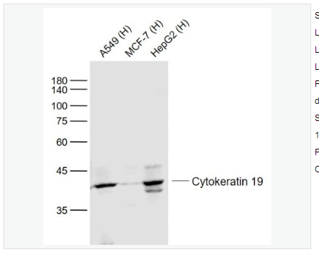 Anti-Cytokeratin 19 antibody-细胞角蛋白19单克隆抗体,Cytokeratin 19