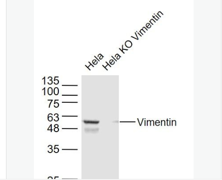 Anti-Vimentin antibody-波形蛋白抗体,Vimentin