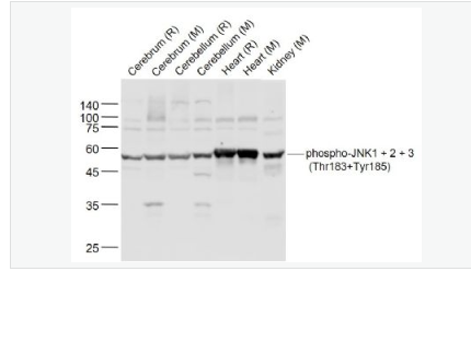 Anti-phospho-JNK1 + 2 + 3-磷酸化氨基末端激酶1/2/3抗体,phospho-JNK1 + 2 + 3 (Thr183+Tyr185)