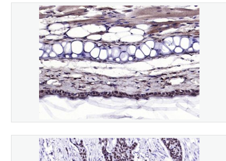 Anti-human P53 antibody-肿瘤抑制基因P53蛋白抗体,human P53