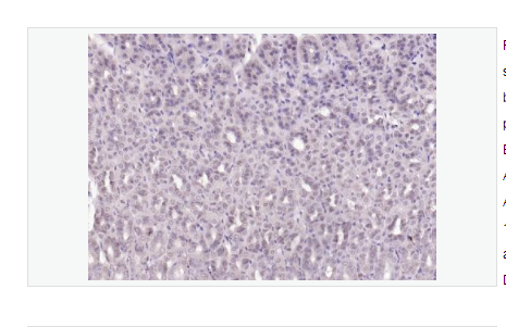 Anti-SPHK2  antibody -鞘氨醇激酶2单克隆抗体,SPHK2