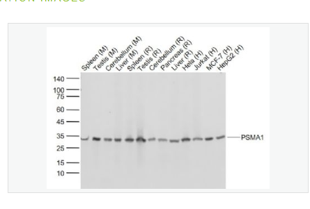 Anti-PSMA1 antibody-蛋白酶体PSMα1重组兔单克隆抗体,PSMA1