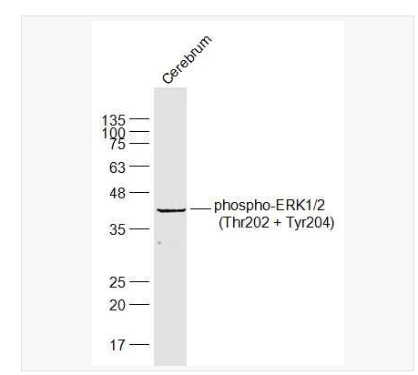 Anti-phospho-ERK1/2 -磷酸化丝裂原活化蛋白激酶1/2抗体,phospho-ERK1/2 (Thr202 + Tyr204)