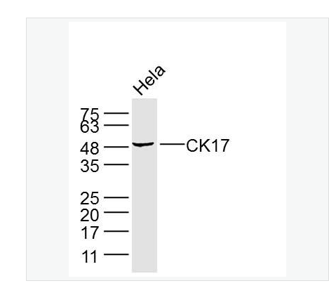 Anti-CK17 antibody-细胞角蛋白17单克隆抗体,CK17