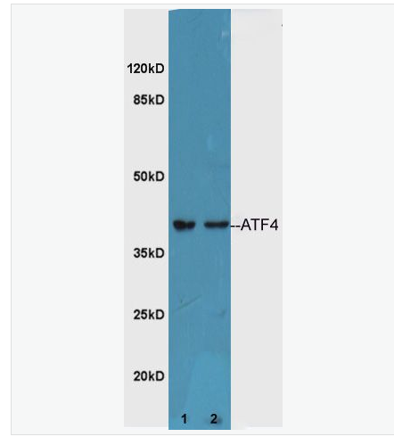 Anti-ATF4 antibody-活化轉(zhuǎn)錄因子4抗體,ATF4