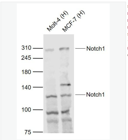 Anti-Notch1 antibody-跨膜受体蛋白Notch-1抗体,Notch1