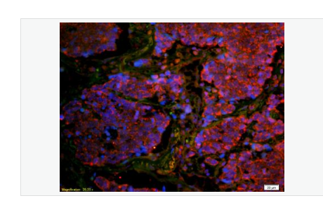 Anti-CD8B antibody-CD8β链（CD8-β）抗体,CD8B