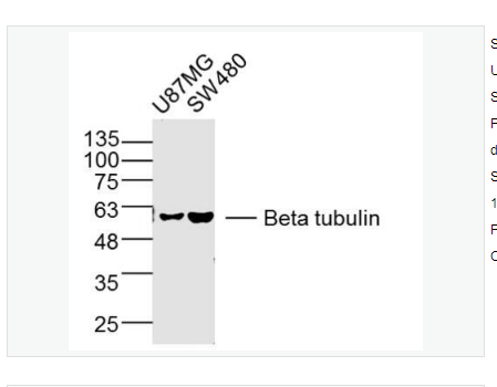 Anti-Beta tubulin-微管蛋白β tubulin/Tubulin β（内参）单克隆抗体,Beta tubulin (Loading Control)
