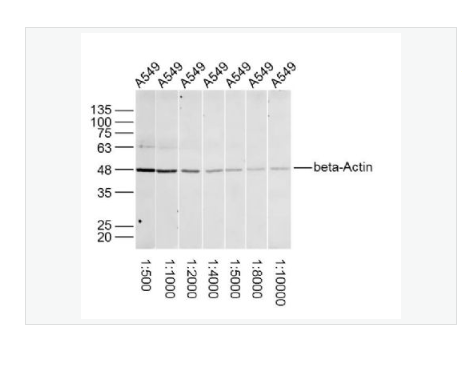 Anti-beta-Actin -β-肌动蛋白/β-Actin（内参）抗体,beta-Actin (Loading Control)