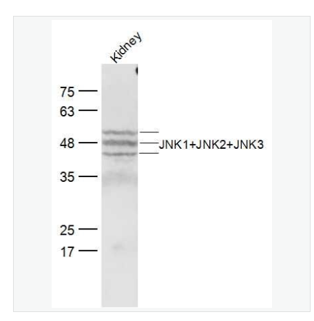 Anti-JNK1+JNK2+JNK3 antibody-氨基末端激酶1/2/3抗体,JNK1+JNK2+JNK3