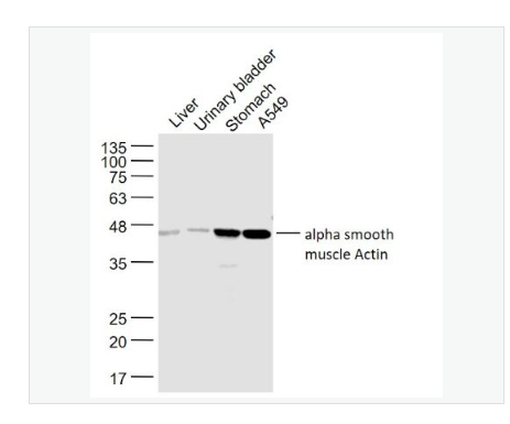 Anti-alpha smooth muscle -肌動(dòng)蛋白α/α-SMA/α Actin抗體,alpha smooth muscle Actin