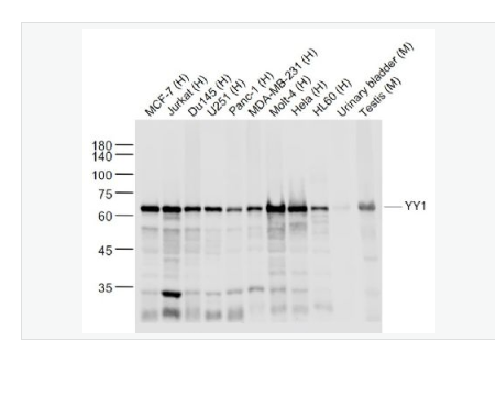Anti-YY1 -核转录调节因子YY1 （核内参）重组兔单克隆抗体,YY1(Nuclear Loading Control)