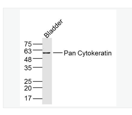Anti-Pan Cytokeratin antibody-广谱细胞角蛋白PCK抗体,Pan Cytokeratin