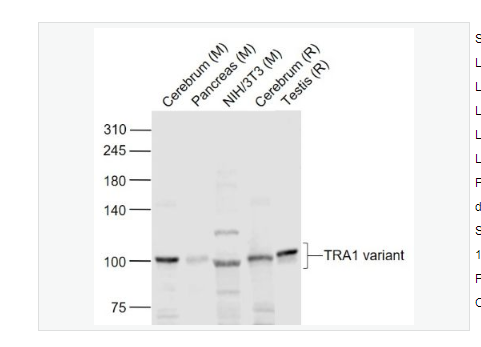 Anti-TRA1 variant antibody -肿瘤排斥抗原gp96 1 变异体抗体,TRA1 variant