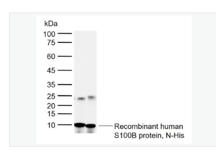 Anti-S100B antibody -人S100B蛋白多克隆抗体,S100B