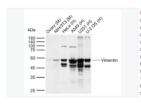 Anti-Vimentin antibody  -波形蛋白抗体,Vimentin
