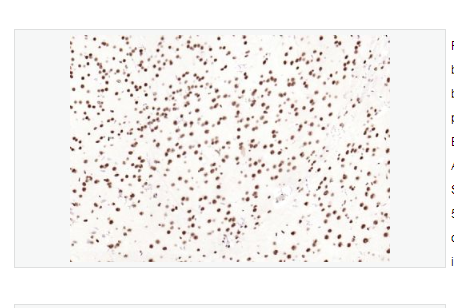 Anti-phospho-SMAD5   -磷酸化细胞信号转导分子SMAD5重组兔单克隆抗体,phospho-SMAD5 (Ser463 + Ser465)