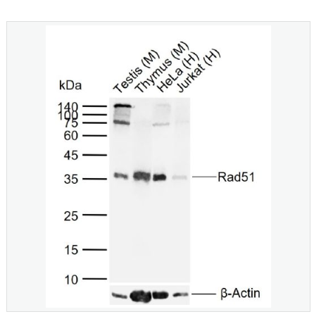 Anti-Rad51 antibody  -Rad51重组兔单克隆抗体,Rad51